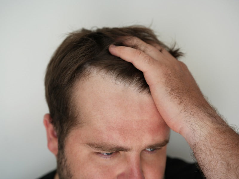 Haargroei bij mannen boven de 50: wat gebeurt er eigenlijk - en wat helpt echt?